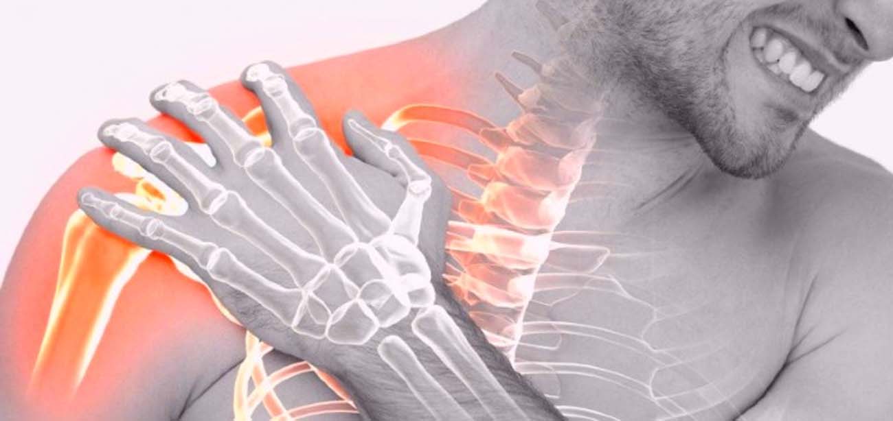 Frozen Shoulder